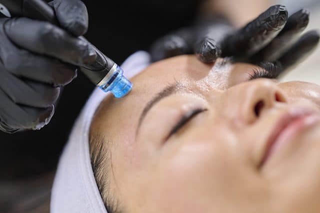 A woman receiving a Hydrafacial