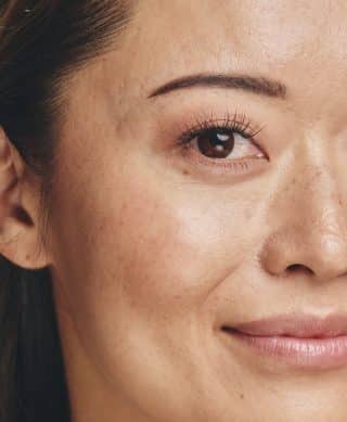A close up of a client's face showing her smooth skin