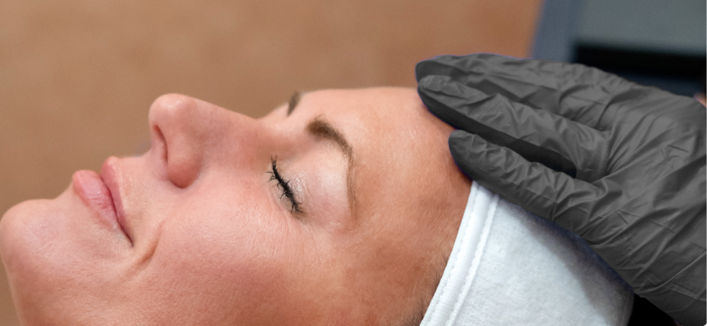 RF microneedling vs microneedling comparison at Elase Med Spa