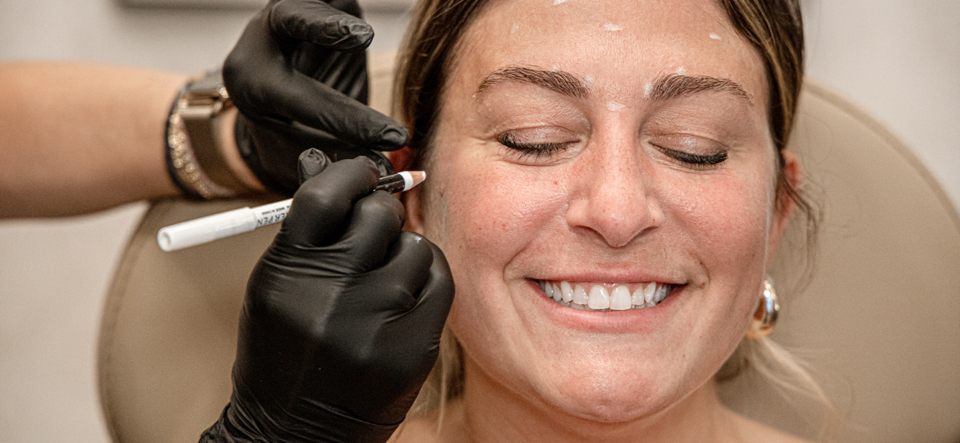 Breaking Down the Amount of Botox Units per Area