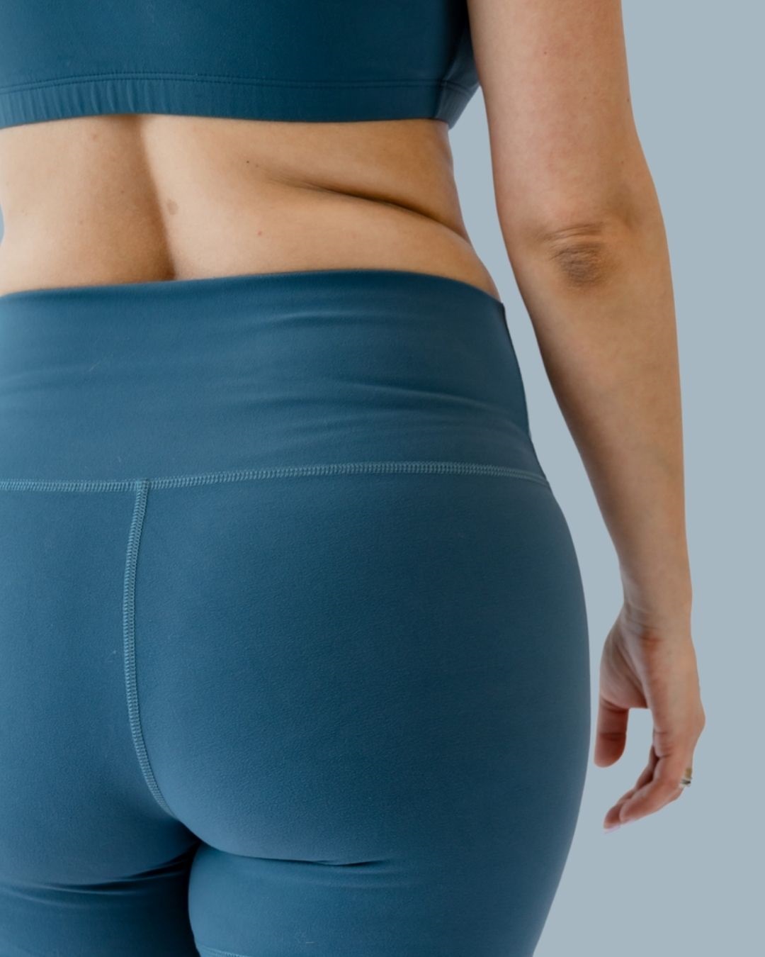 Sculptra Butt Lift