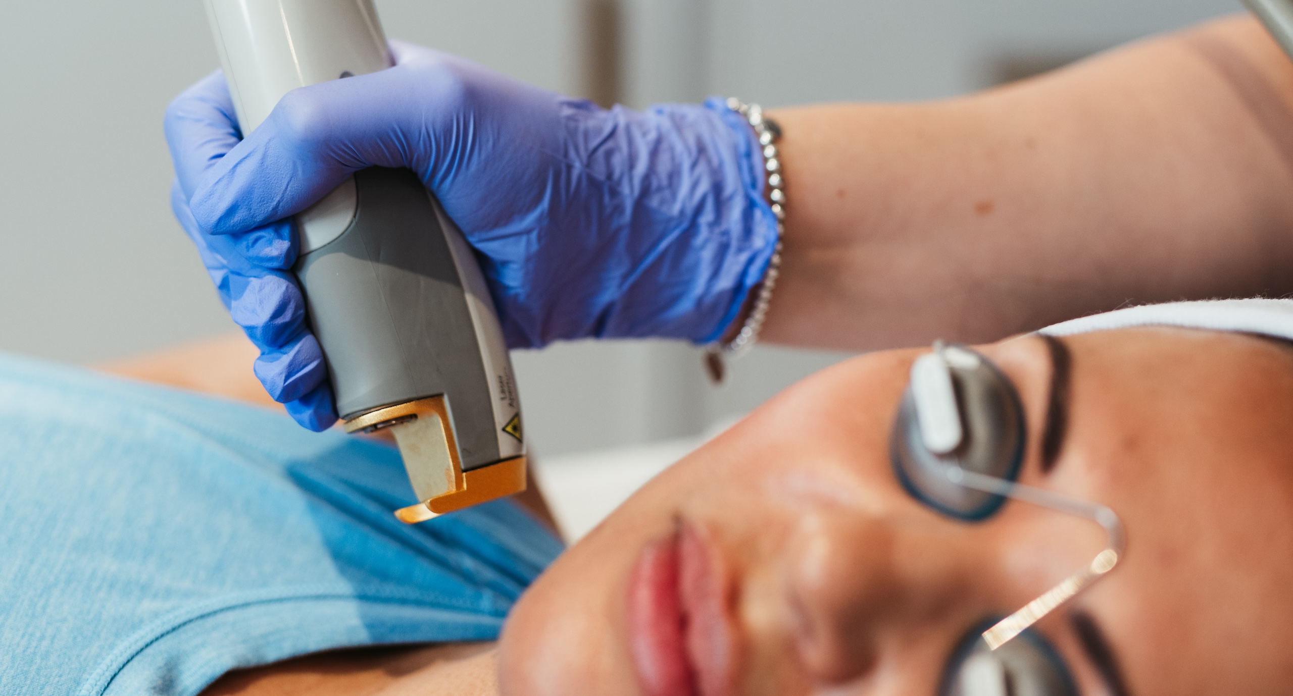 Elase laser vein removal treatment on client's face