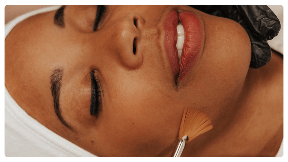 Client getting a chemical peel treatment