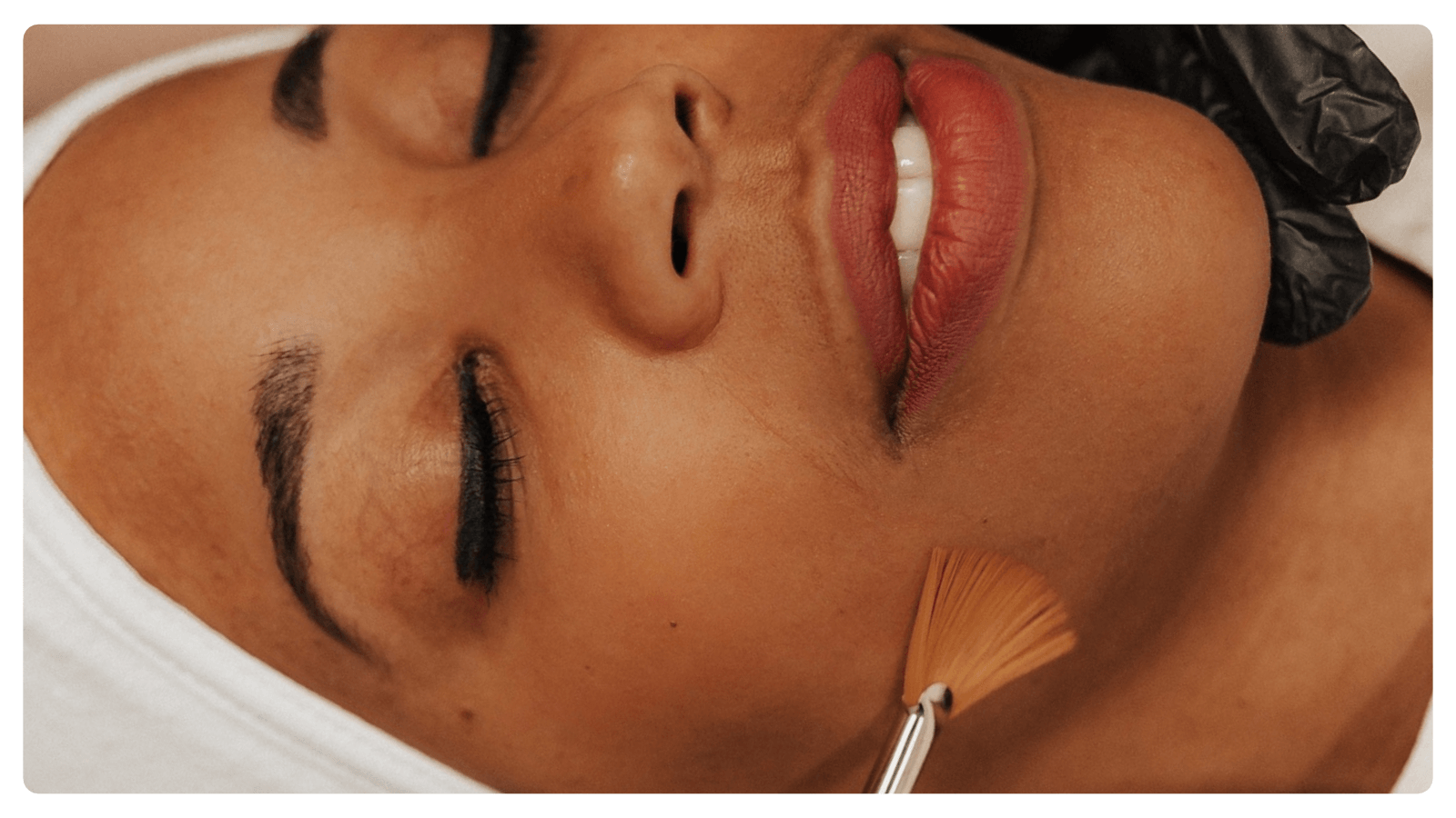 Client getting a chemical peel treatment